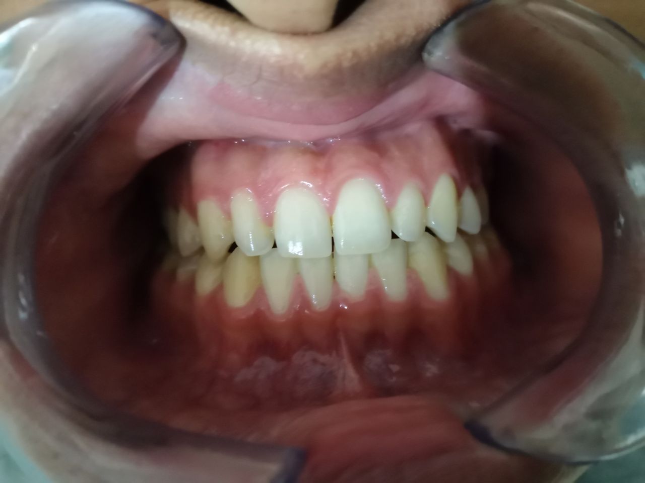 Alejandro Alcocer Flores-23