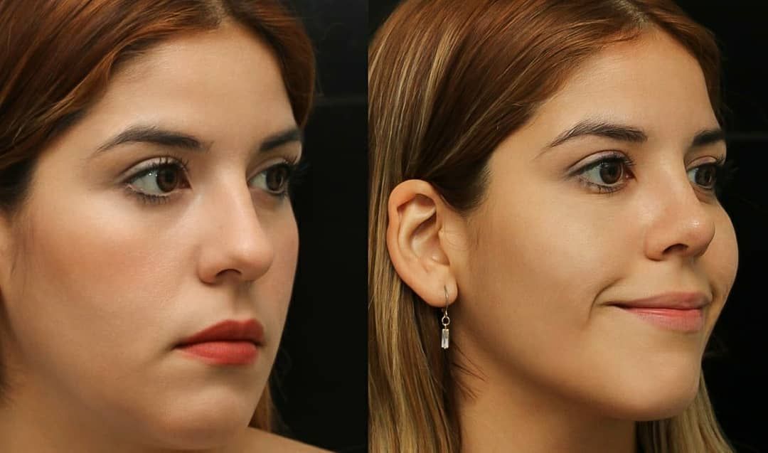 Angel Castro Urquizo-199