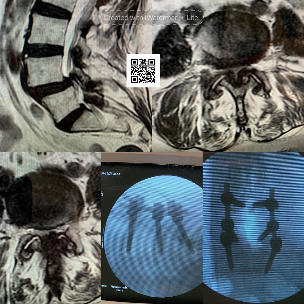 Gustavo E Ramirez Reyna-27