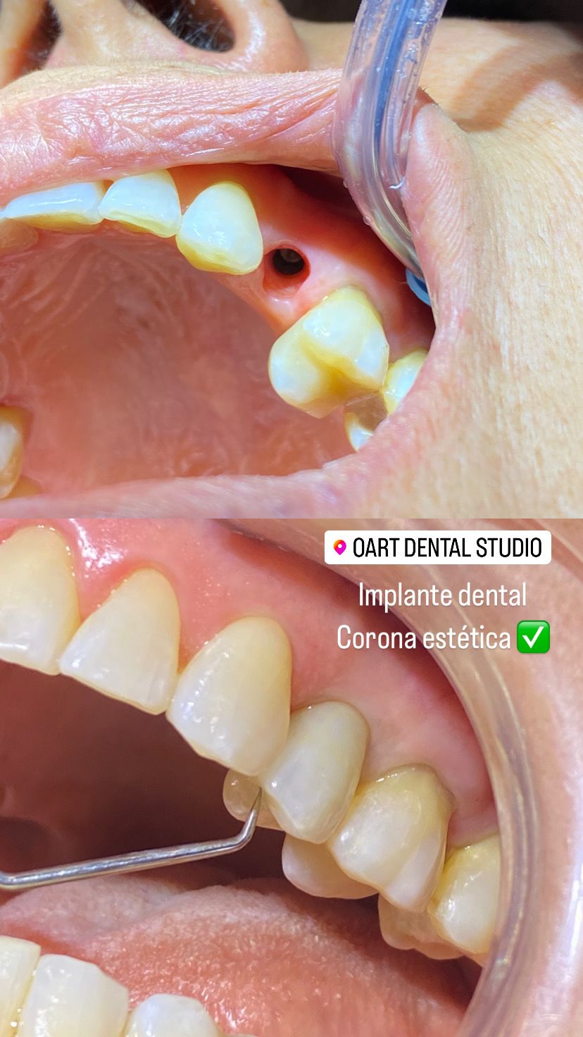 Cinthya Arelí Hernández Ramírez-6