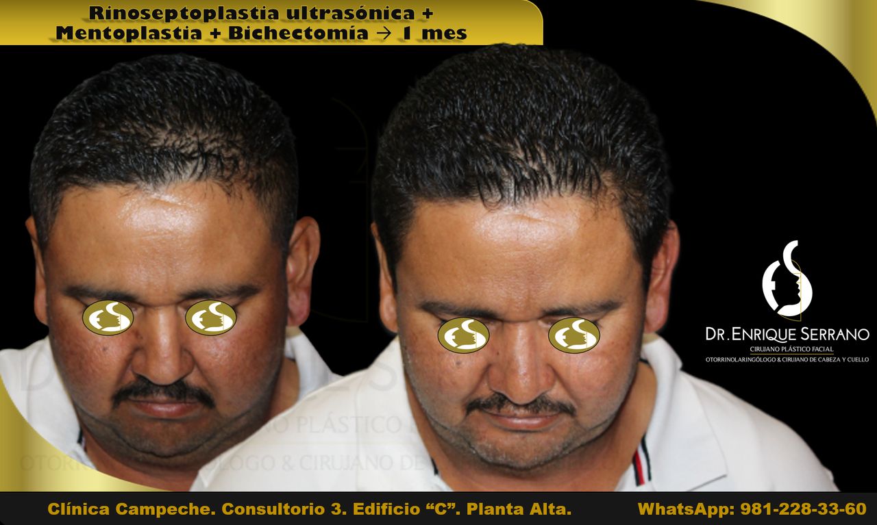 Enrique Serrano Cruz-28