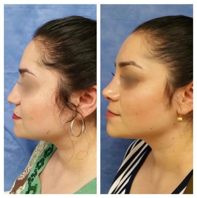 Ana Guadalupe Torres León-5