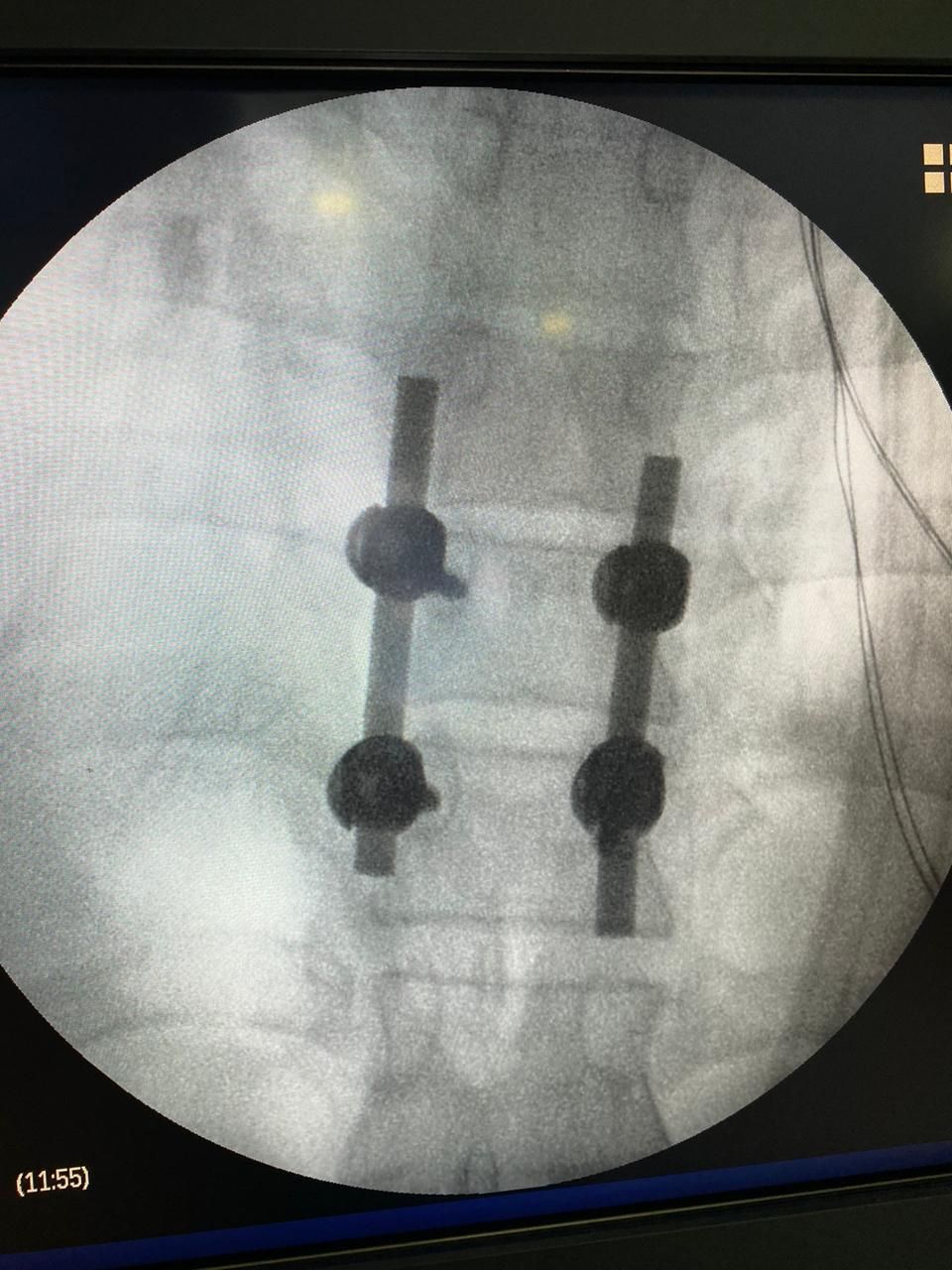 Juan José Luévano De La Cruz-39