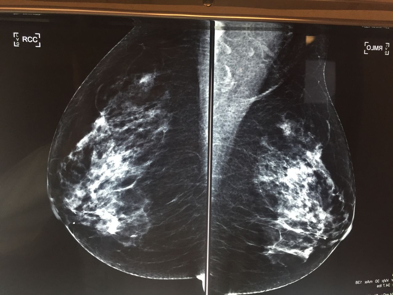 Alfonso Valdés Domínguez-6