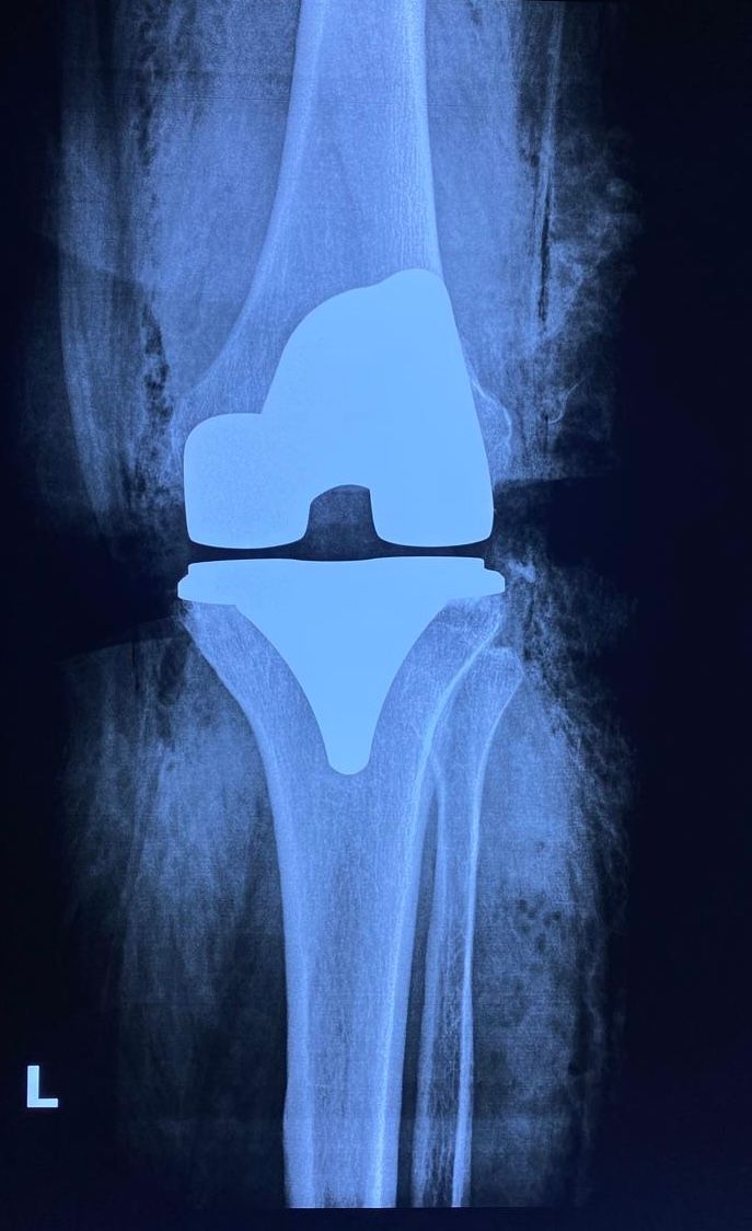 Cristian Ernesto Murillo Medina-3