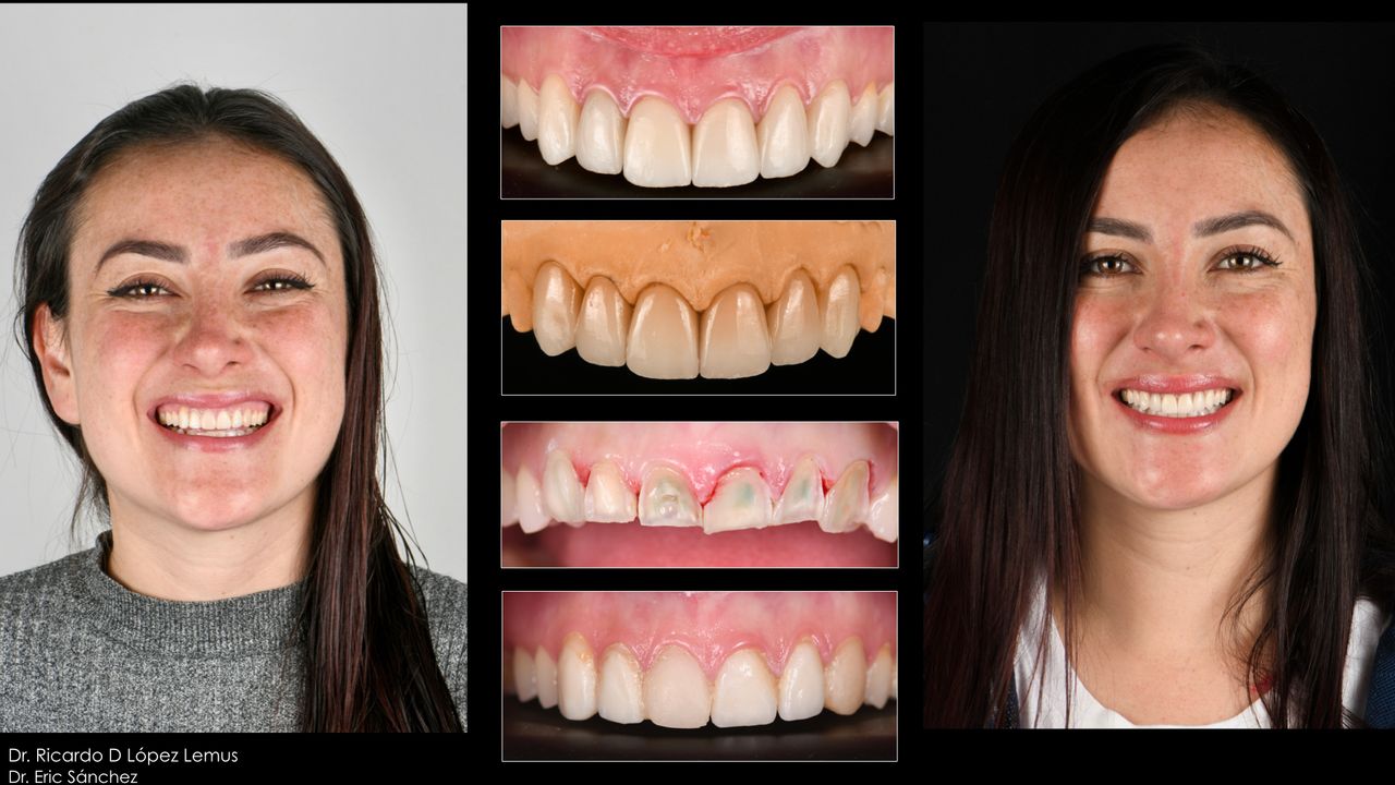 Ricardo López Lemus-53