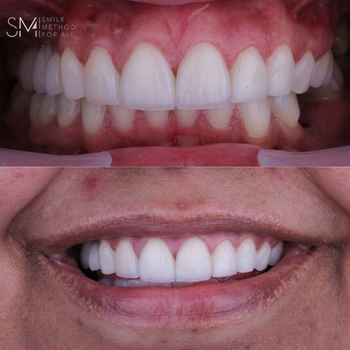 Arturo Mendez Valencia-36