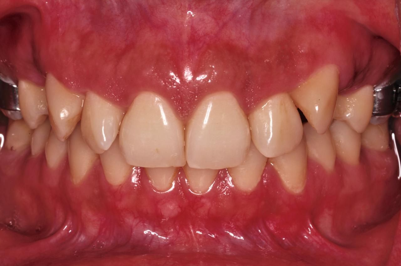 José Alberto Martínez Basulto-21