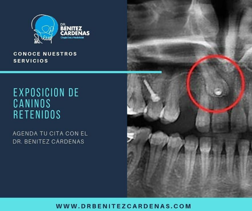 Oscar Arturo Benítez Cárdenas-6