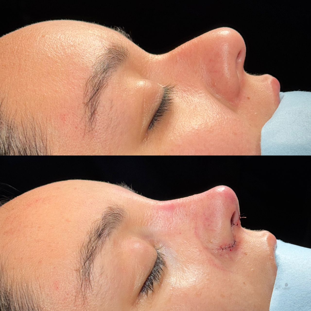 Angel Castro Urquizo-215