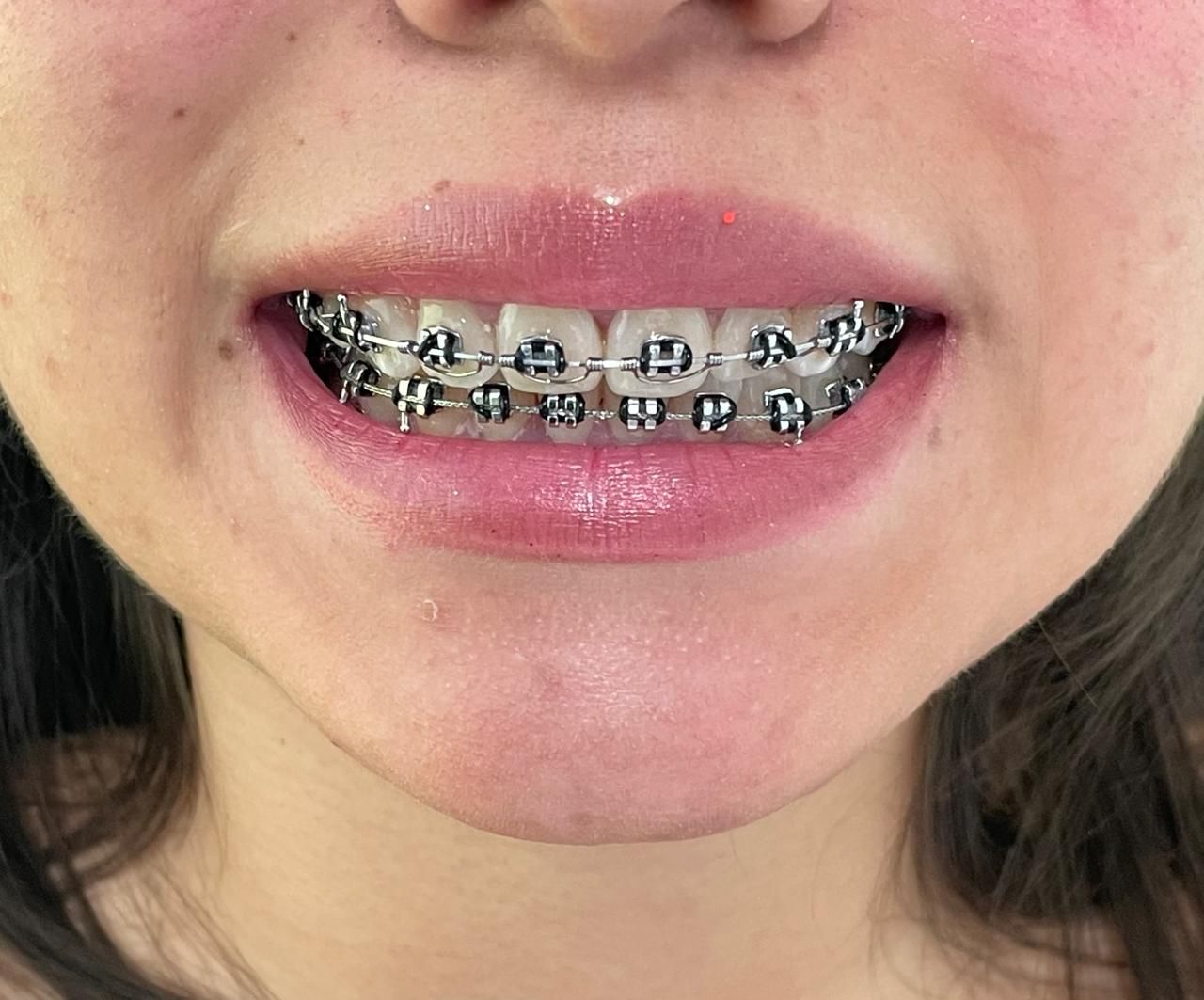 Anuar Becerril Castro-0