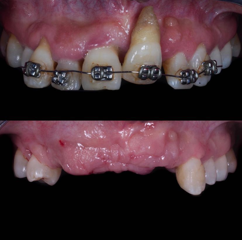 Dario Ortega Aceves-36