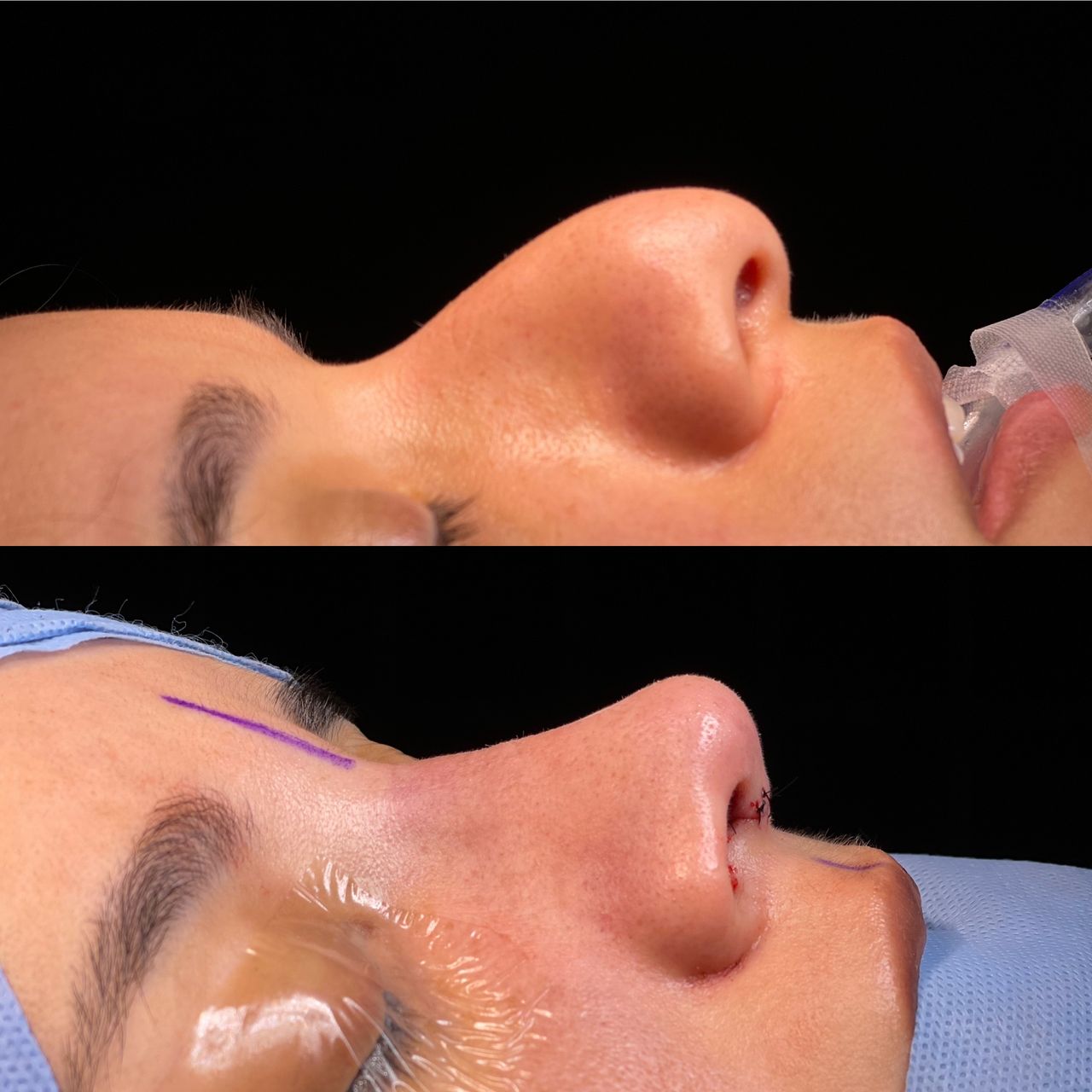 Angel Castro Urquizo-190