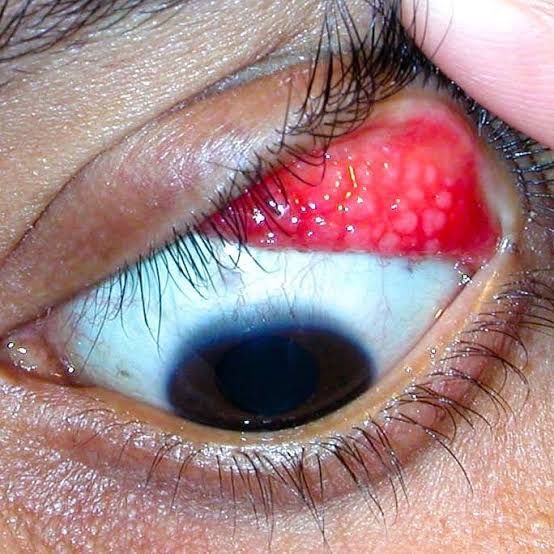 Álvaro Garza Arreola-4