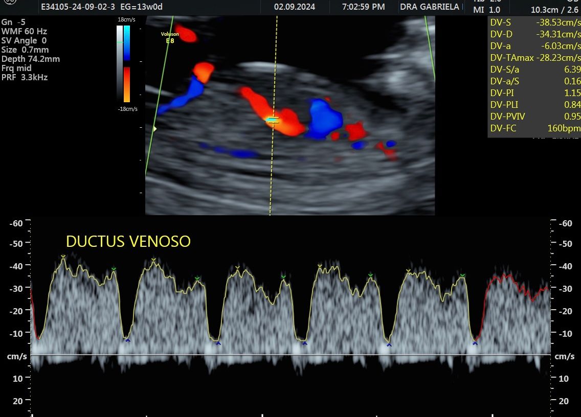 Gabriela Delgado Serrano-5