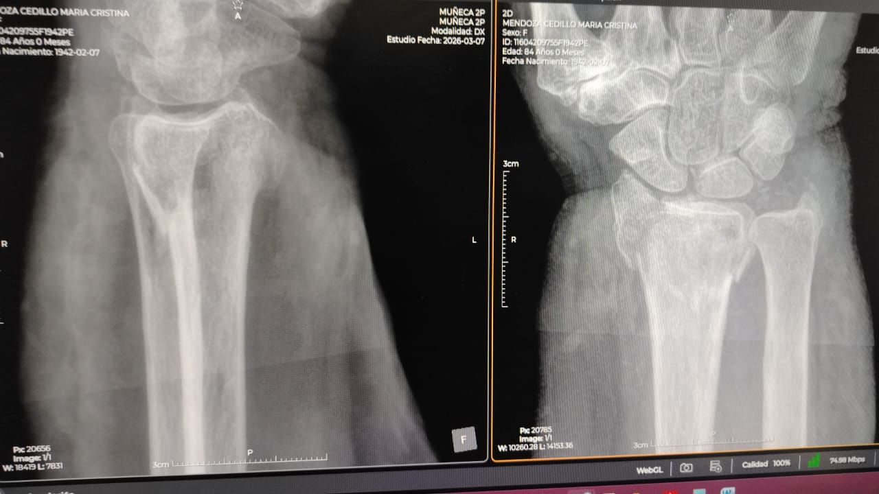 Alejandro Irisson-28