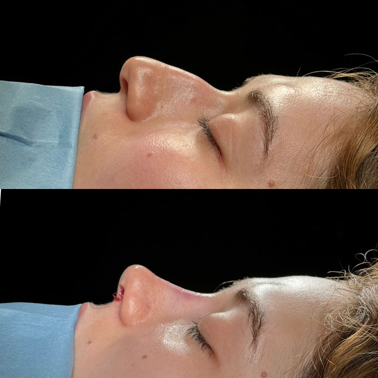 Angel Castro Urquizo-114