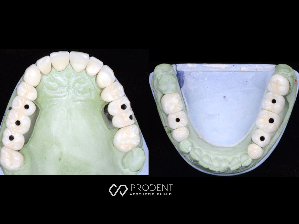 Ramiro Ivan Pérez Murillo-55