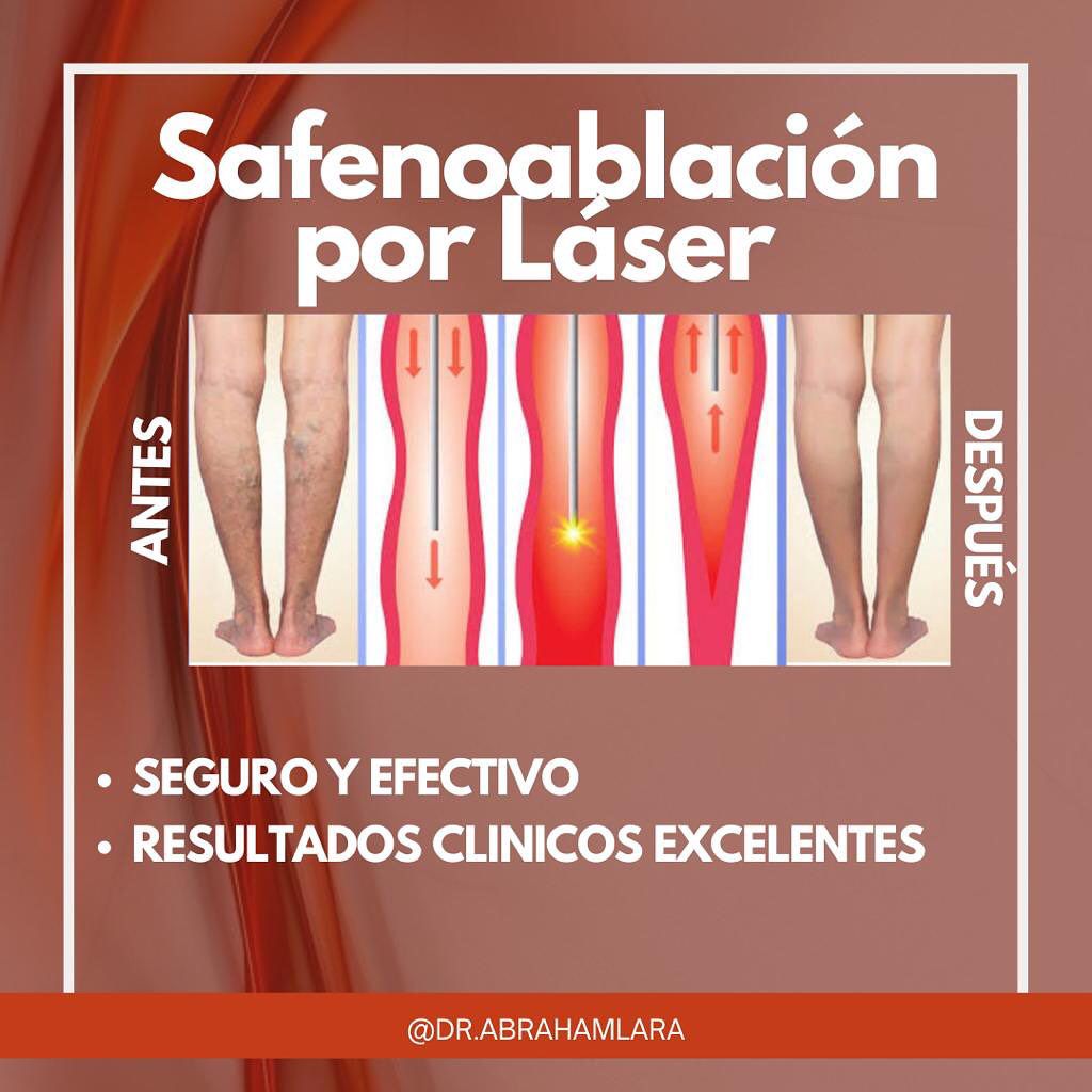 Miguel Abraham Lara Perez-35