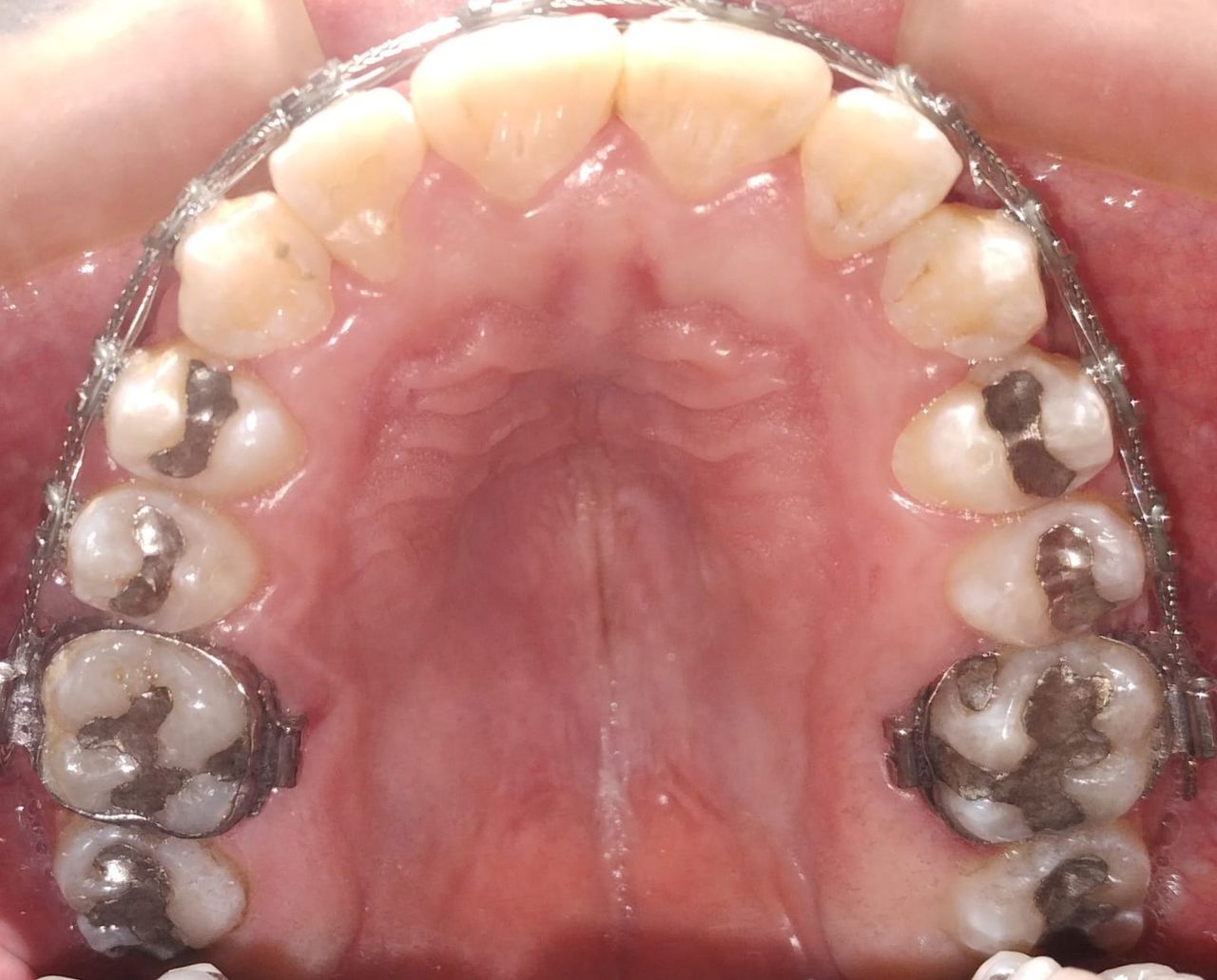 Luis Ernesto Calva Valdez-13