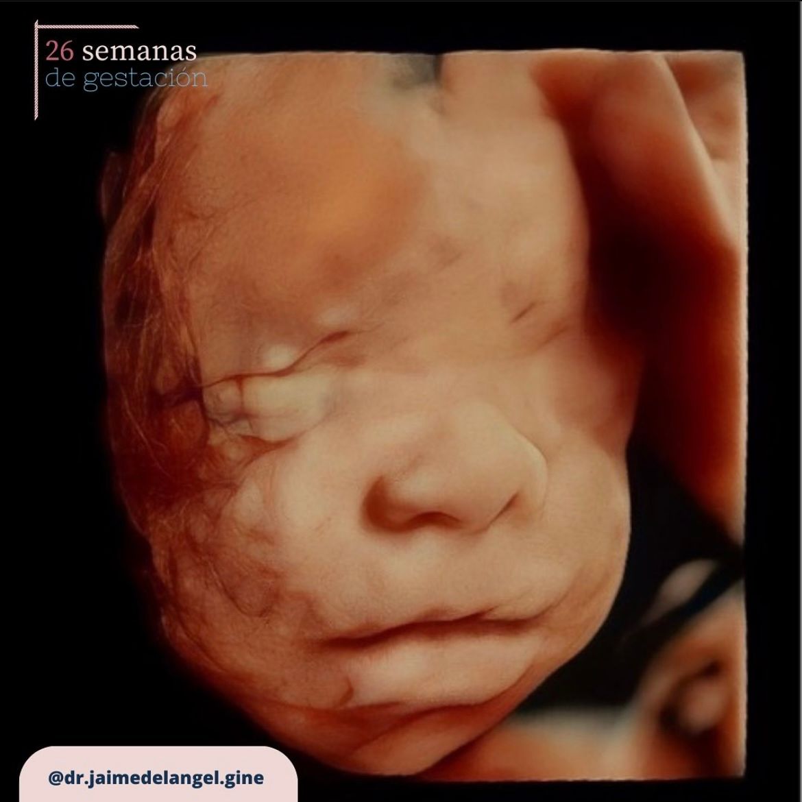 Jaime Eduardo Del Ángel Ramos-9