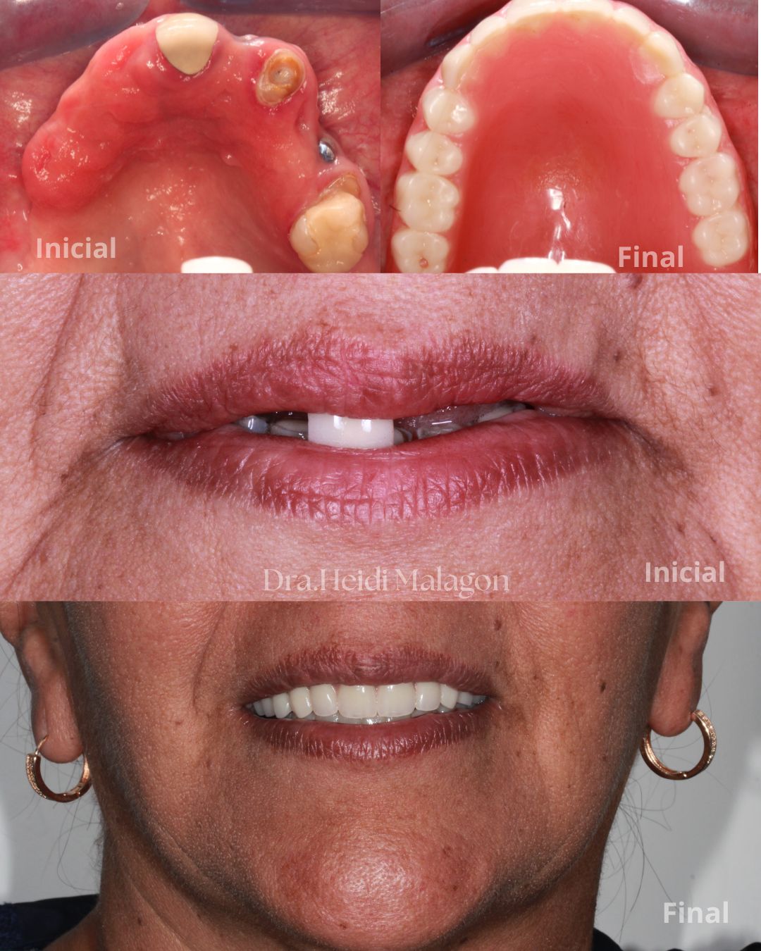 Heidi Mendoza Malagón-0