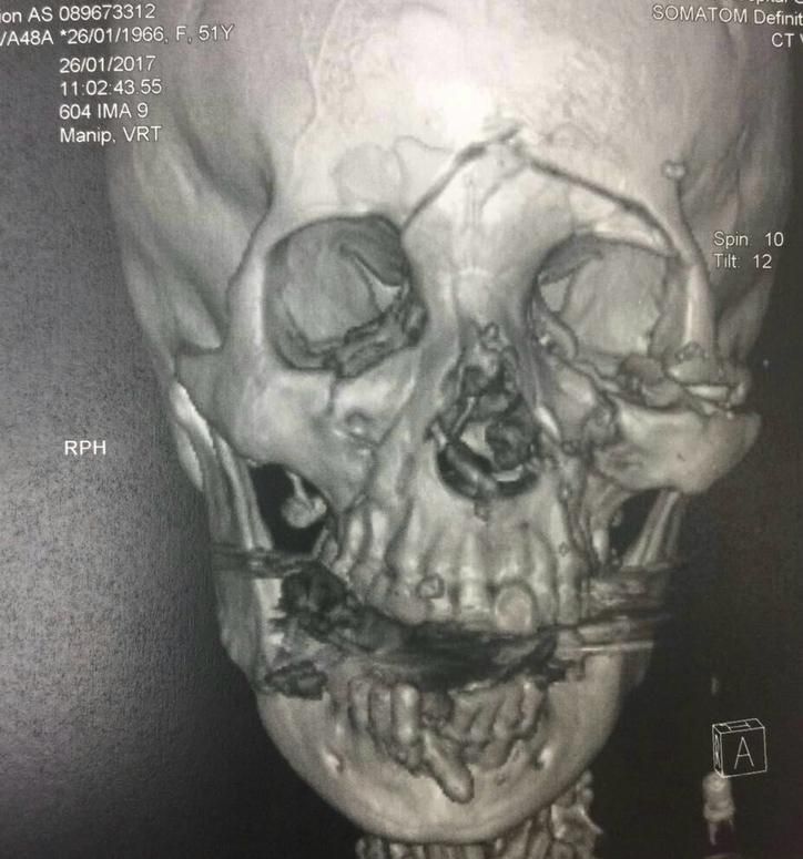 Luis Enrique Cruz Hernández-23