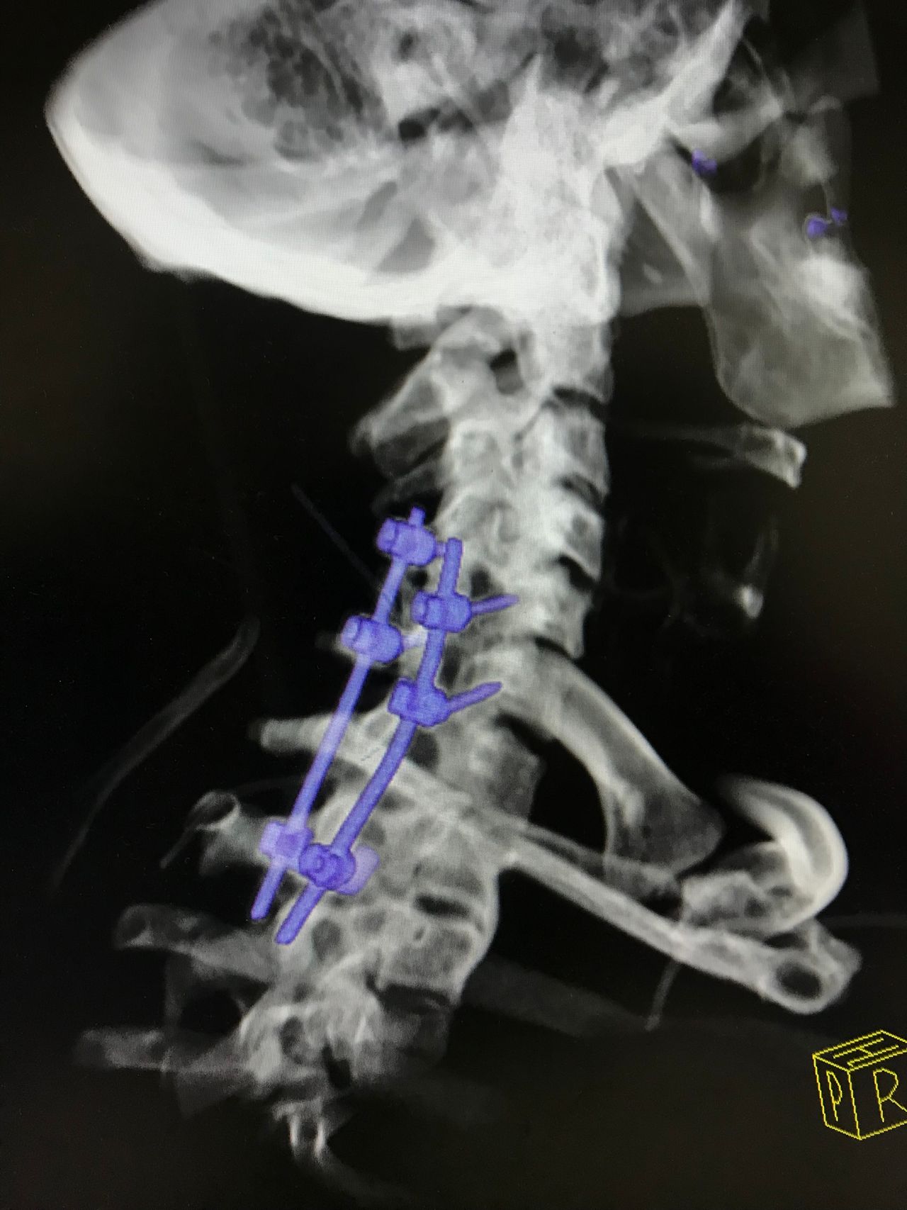 Rafael Maciel Morfin-52