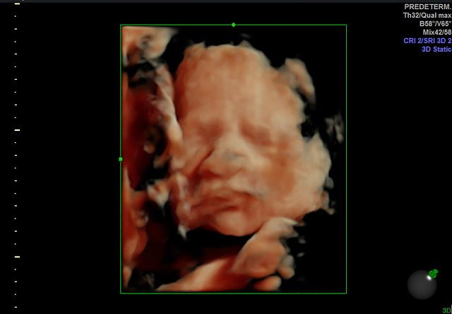 Graciela Elizabeth De La Torre Alvarez-13