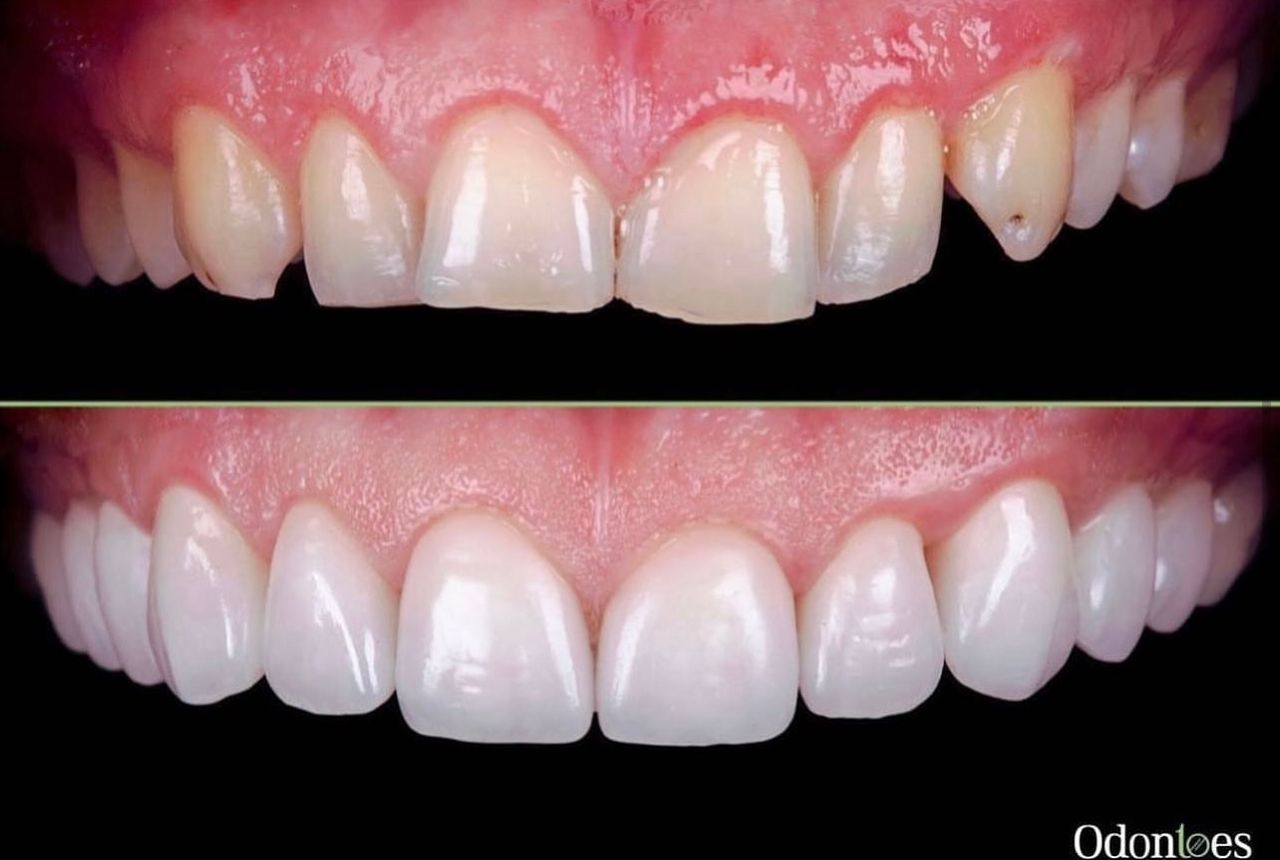 Raúl Euán Salazar-12