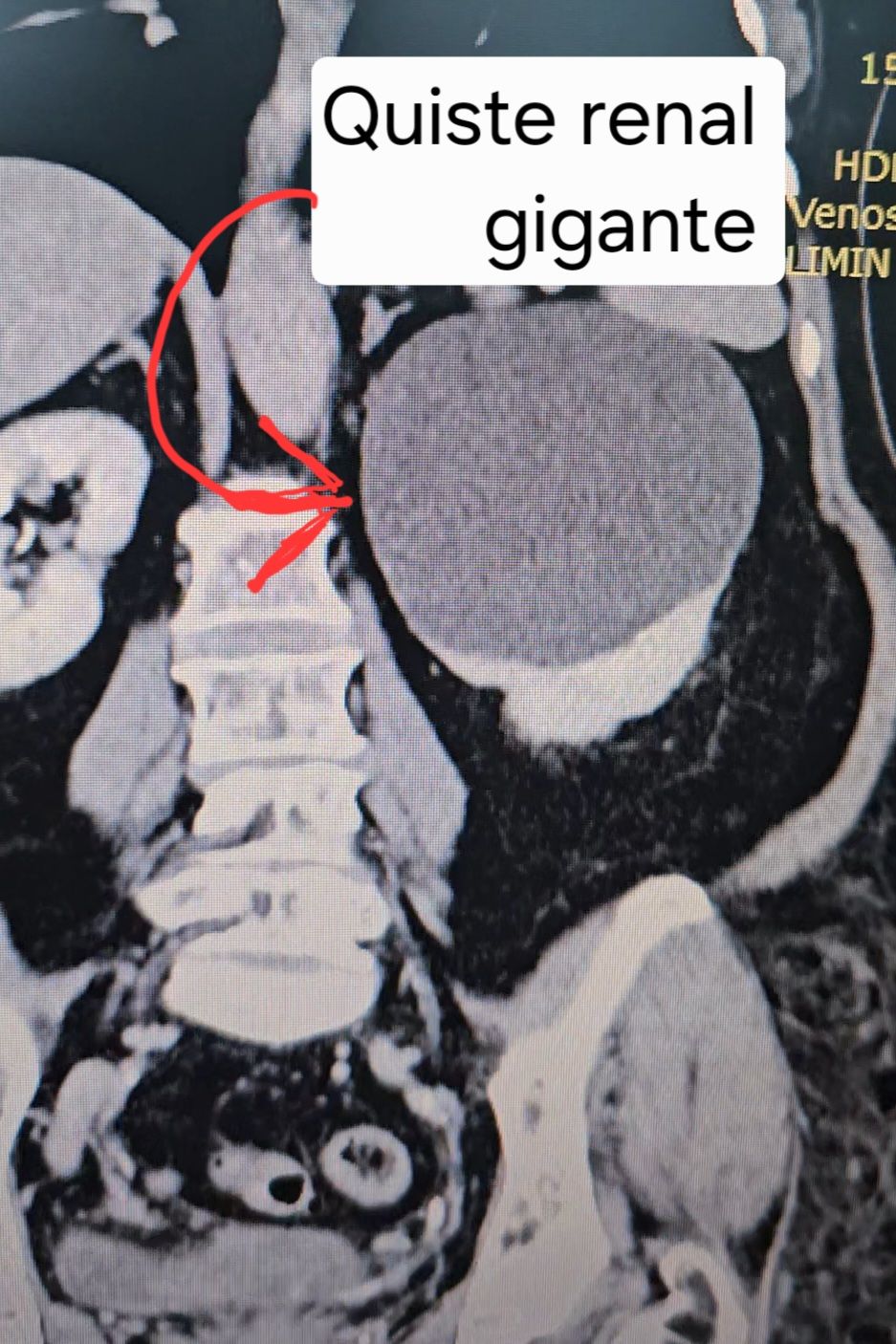 Efrain Barradas Huervo-25