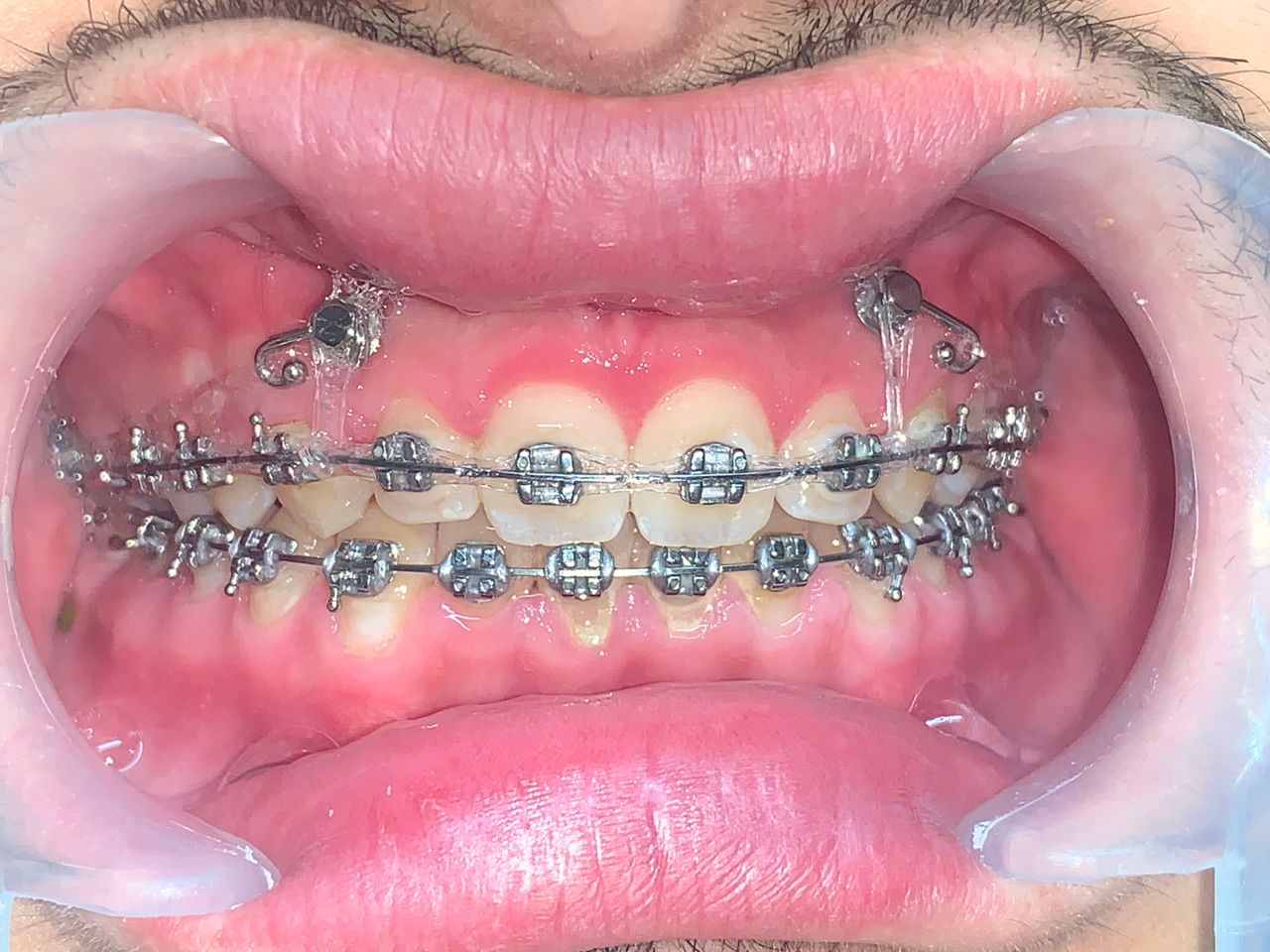 Marinete Voirol Ayala-12