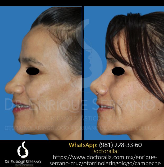 Enrique Serrano Cruz-56