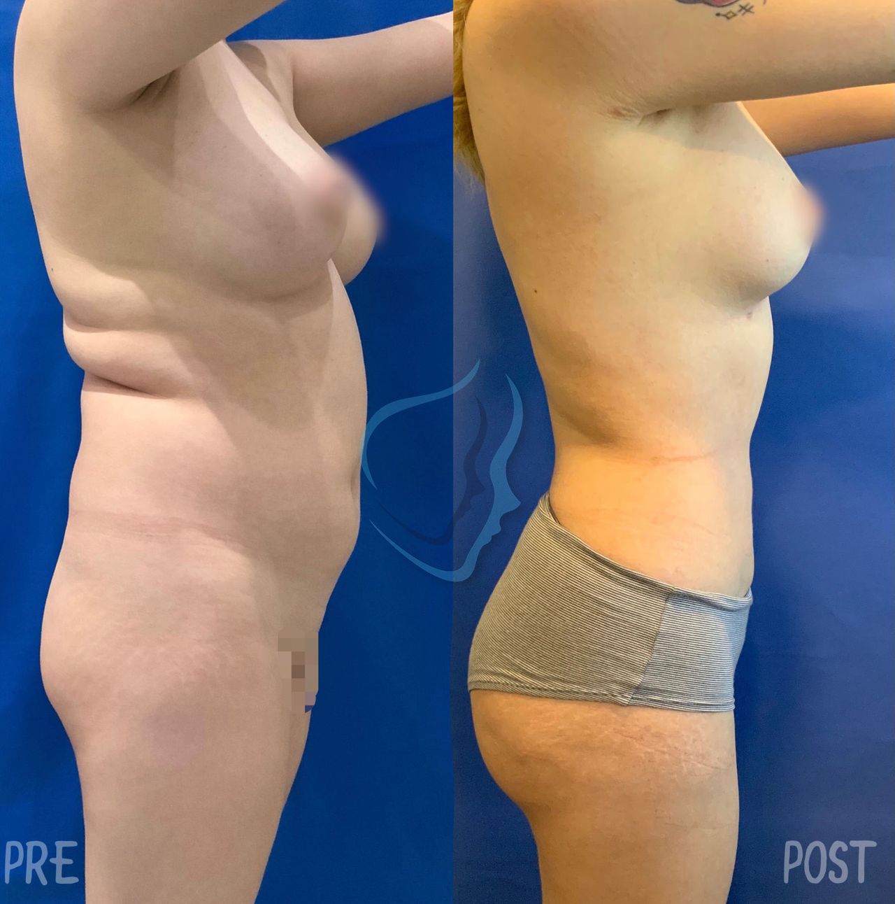 Giuseppe Tanzillo-19