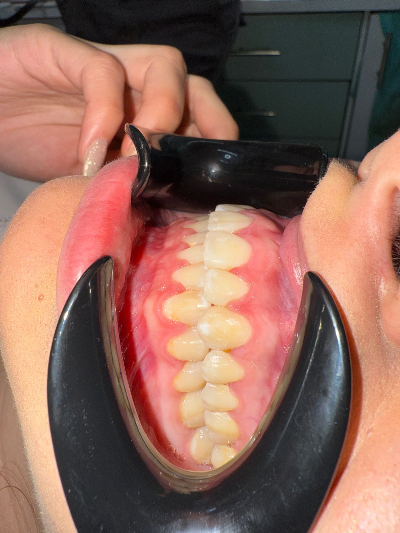 Jair Contreras García-68