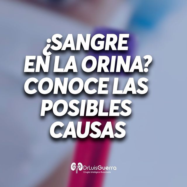 Luis Alberto Guerra Zepeda-106