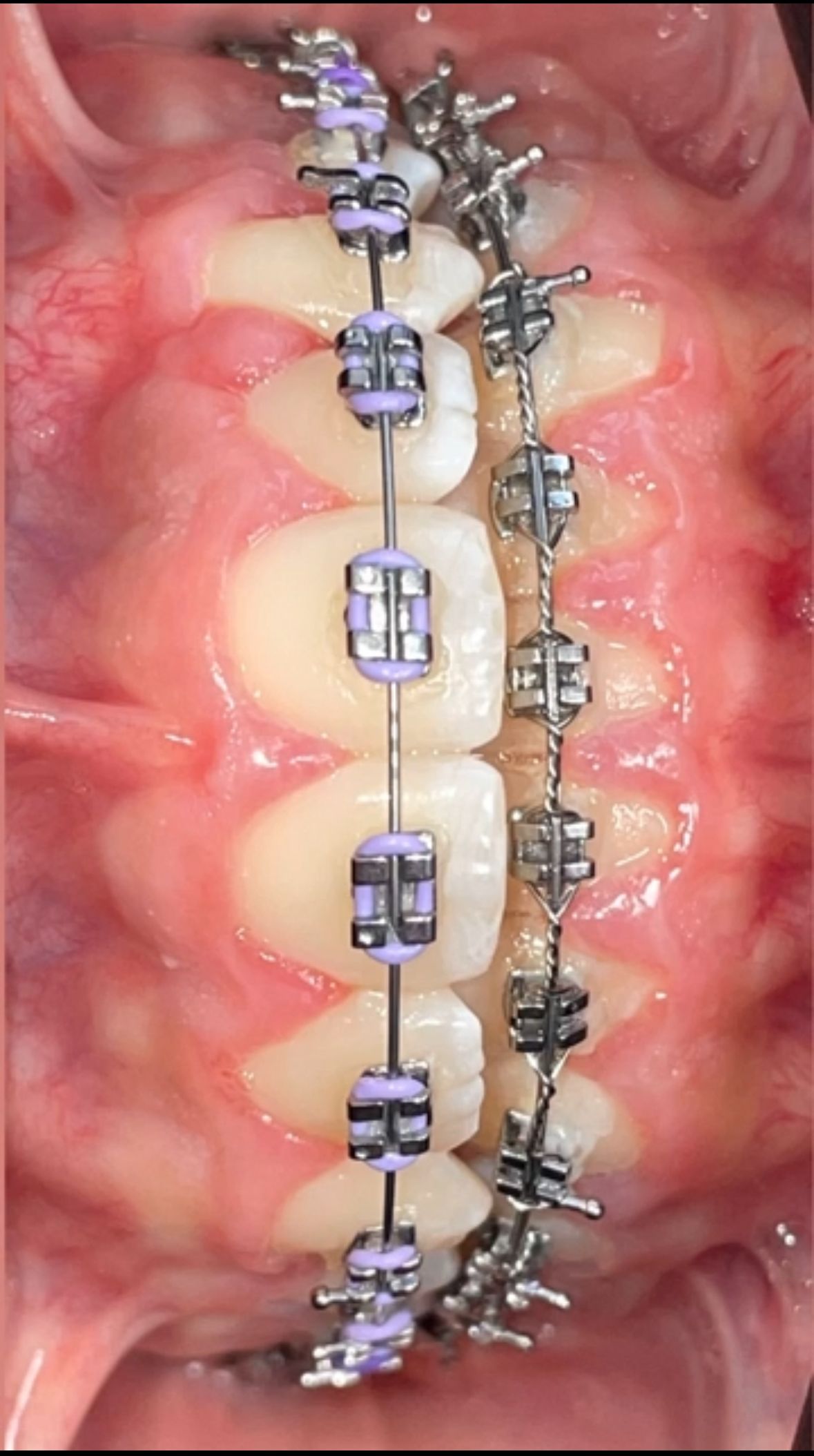 Angélica Daniela Tirado Escalante-0