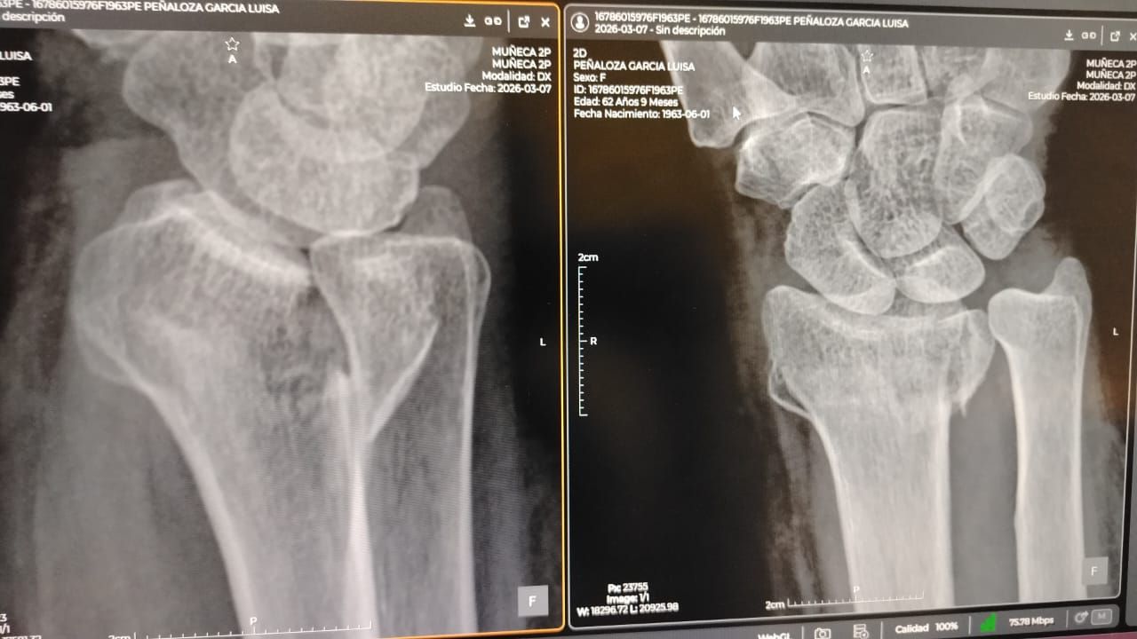 Alejandro Irisson-13