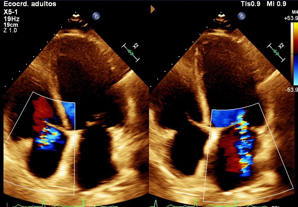 Heriberto Pruneda Ayala-6