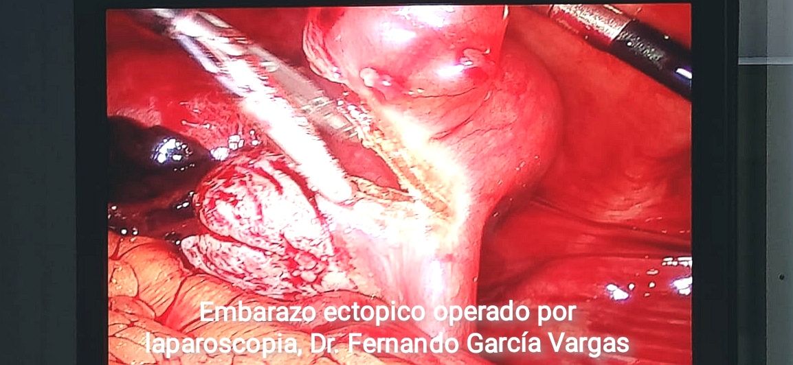 Fernando Garcia Vargas-3