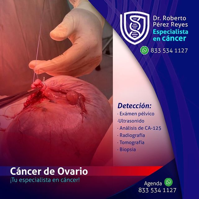 Roberto Pérez Reyes-3