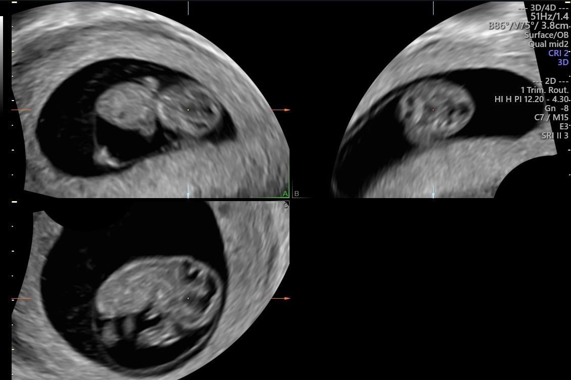 Alberto Bañuelos Peña-3