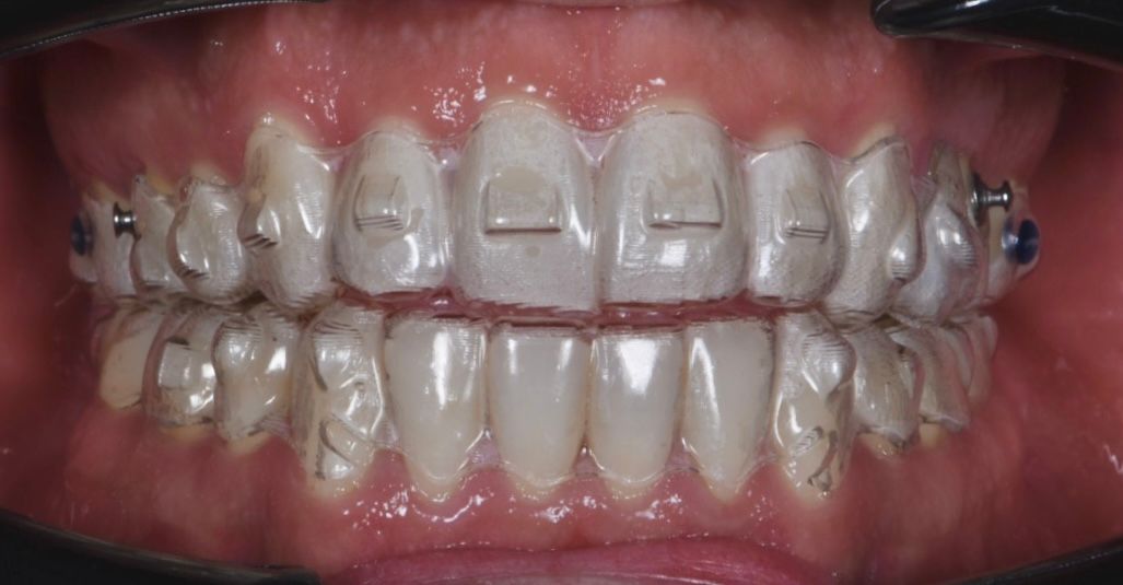 Rodrigo García Martínez-8