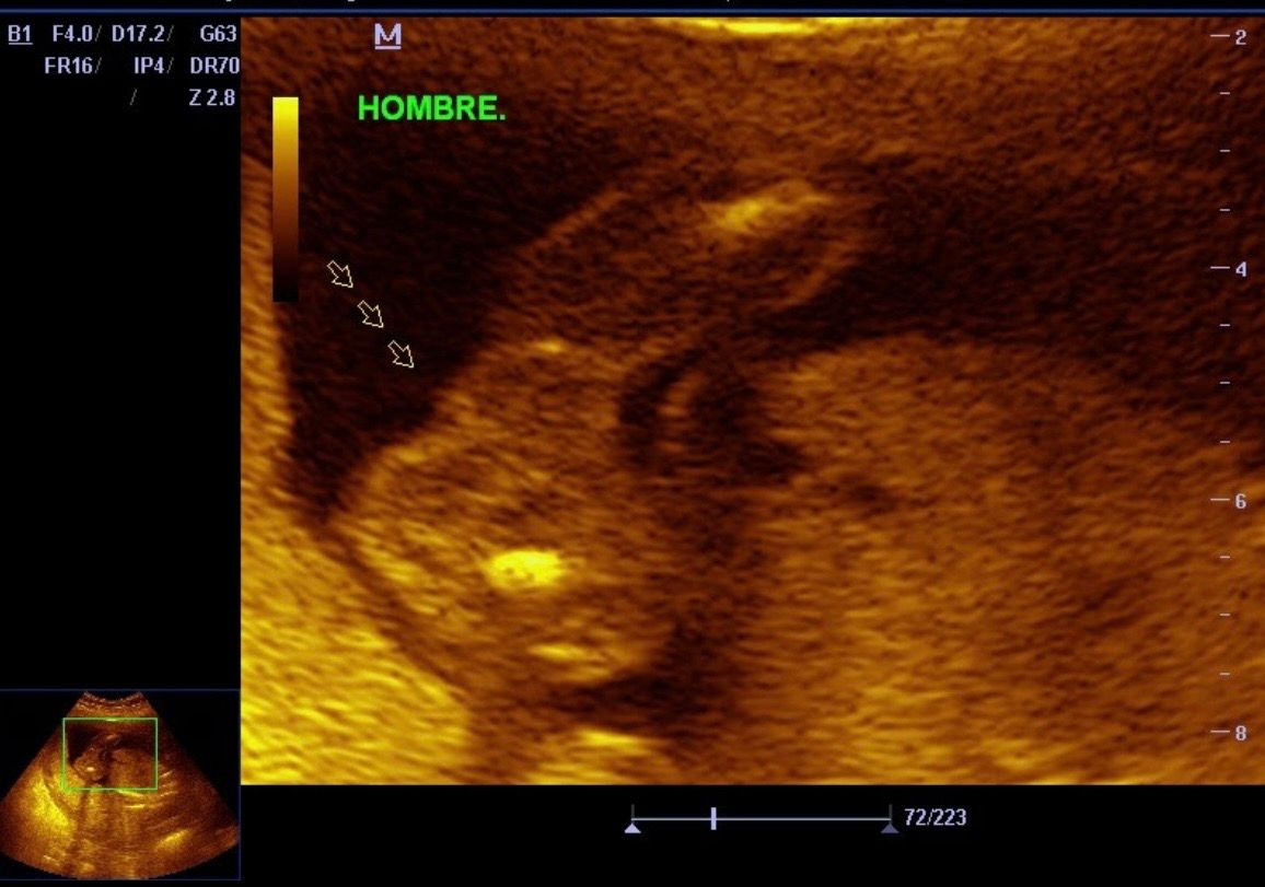 Luis Reynerio Téllez Gómez-10