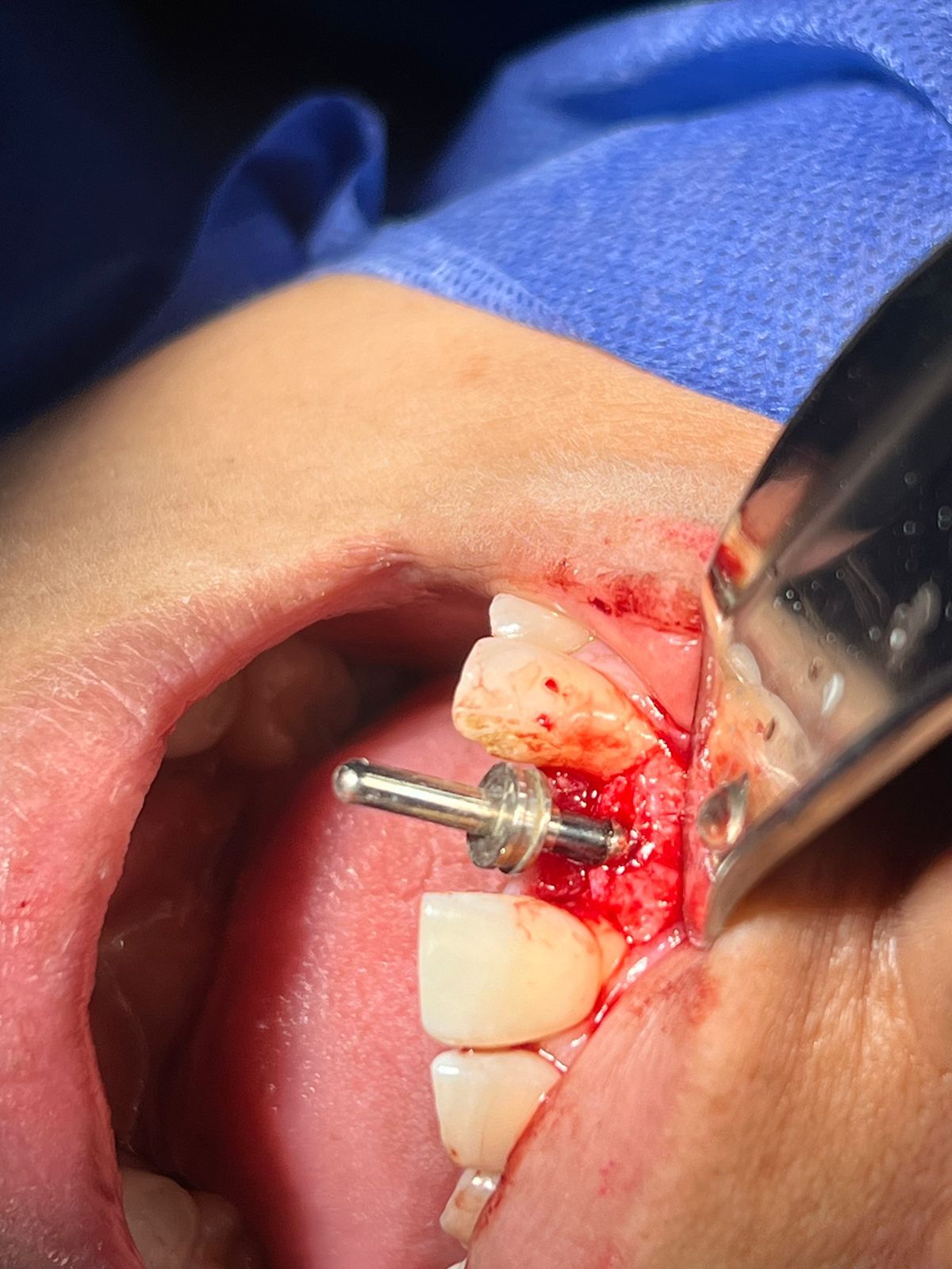 José Antonio Vázquez Mendoza-14