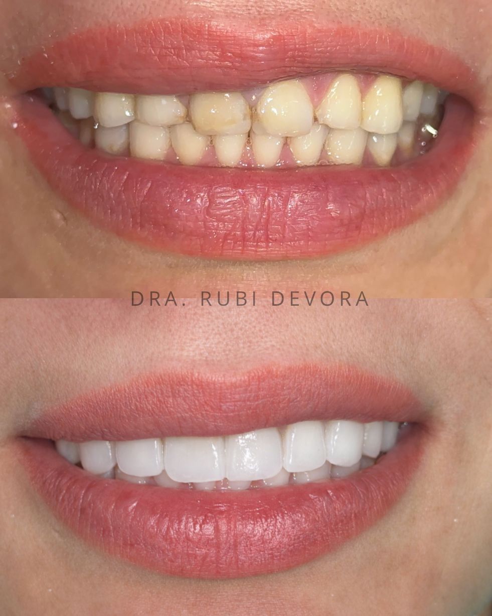 C Rubi Devora Figueroa-13