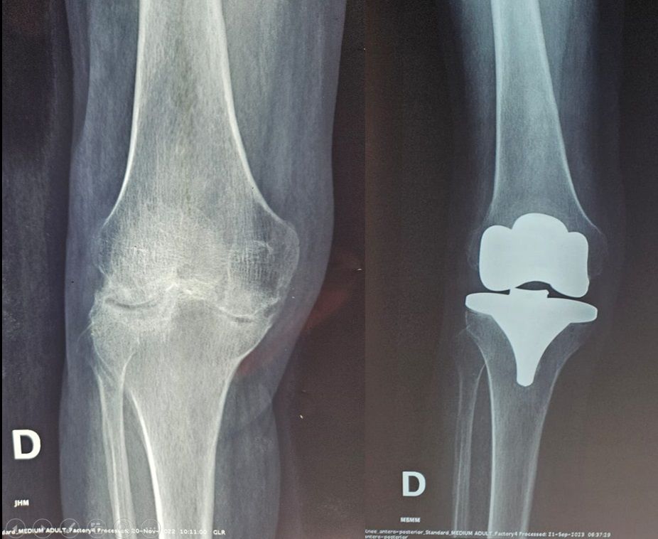 Luis Castañón Robles-1