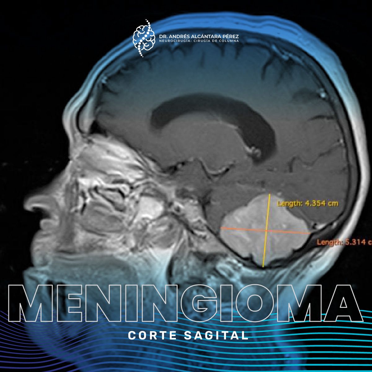 Andres Alcántara Pérez-17