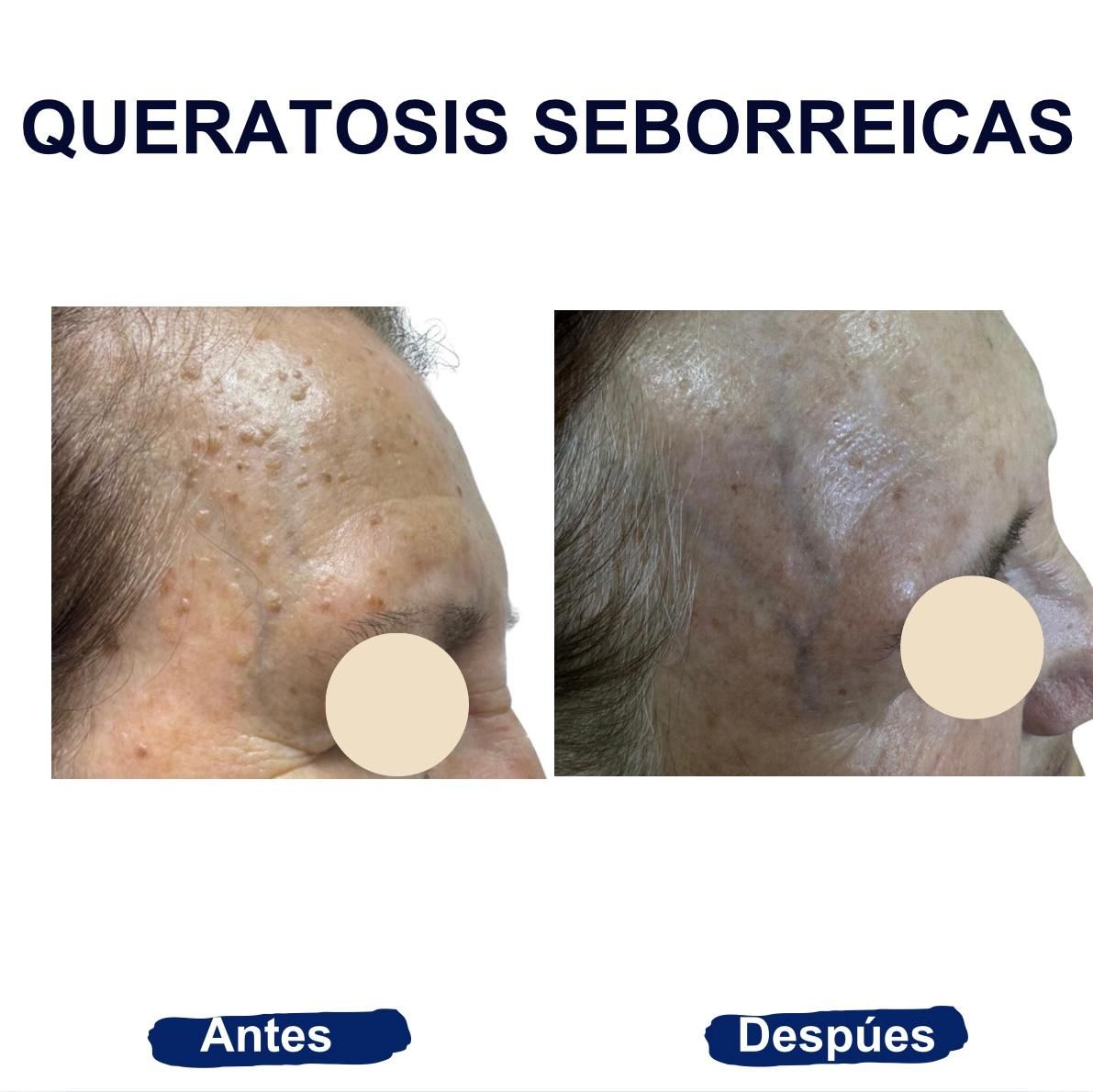 Itzel Anayn Flores Reyes-46