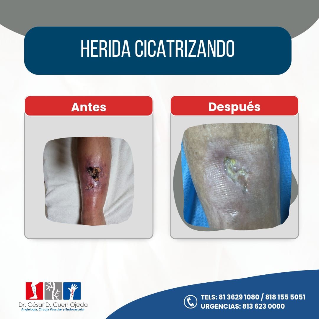 César Daniel Cuen Ojeda-10